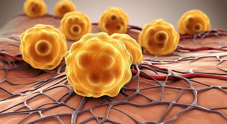JPG 편집이미지 세포 사람없음 쌓기 디지털합성 혈관 콜레스테롤 내장지방 편집실사 AI컴퓨터그래픽 AI콘텐츠 모션 장기_의학 지방_기름 CG 파일형식