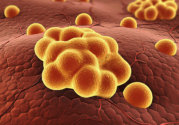 JPG 편집이미지 세포 사람없음 디지털합성 적혈구 막힘 콜레스테롤 내장지방 편집실사 AI컴퓨터그래픽 AI콘텐츠 지방_기름 CG 혈구 파일형식
