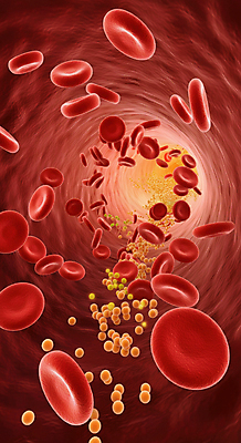 JPG 편집이미지 건강 사람없음 혈액 디지털합성 혈관 적혈구 혈당 노화 편집3D 혈당급상승 AI컴퓨터그래픽 AI콘텐츠 컨셉 3D 장기_의학 혈구 파일형식