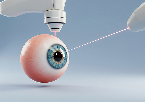 JPG 편집이미지 사람없음 시력 교정 안과 레이저수술 라식수술 라섹 편집실사 AI컴퓨터그래픽 AI콘텐츠 병원 수술 CG 파일형식