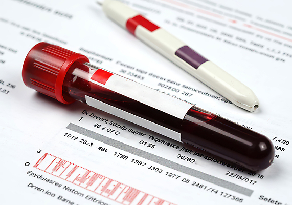 JPG 편집이미지 사람없음 건강관리 당뇨병 채혈 혈당 혈당계 혈액검사 혈액채취 편집실사 AI포토 AI콘텐츠 의학 건강 관리 의료용품 혈액 질병 CG 검사_조사 파일형식