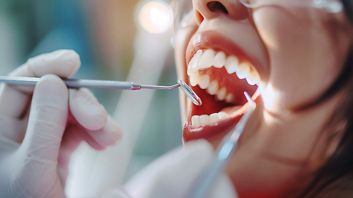 JPG 편집이미지 손 여자 얼굴 치과 입벌림 한명 성인 신체부위 치료 잡기 입 치아 치과의사 수술장갑 치과진료 의료성형뷰티 성인여자한명만 치위생사 구강거울 편집실사 AI인물포토 AI콘텐츠 직업 1 장갑 의학 모션 표정 병원 사람 진료 의사 소화기관 CG 치과용품 여자한명만 성인여자만 파일형식 AI포토