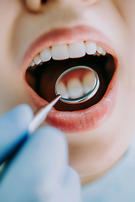 JPG 편집이미지 손 치과 입벌림 한명 성인 신체부위 치료 반사 입 치아 입술 치과의사 수술장갑 치과진료 의료성형뷰티 성인한명만 치위생사 구강거울 편집실사 AI인물포토 AI콘텐츠 직업 1 장갑 의학 표정 병원 사람 진료 의사 소화기관 CG 치과용품 성인만 파일형식 AI포토