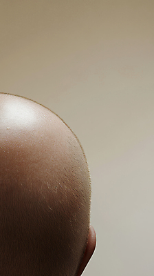 JPG 편집이미지 신체부위 머리카락 머리 피부 두피 탈모 의료성형뷰티 편집실사 AI인물포토 AI콘텐츠 사람 CG 증상 파일형식 AI포토