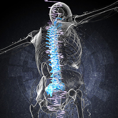 포토 JPG 해외이미지 뼈 골격 사람없음 환자 질병 척추 몸통 방사선 요통 해외202004 해외포토 의학 신체부위 허리통증 파일형식