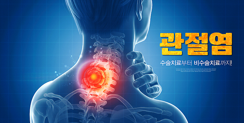 PSD 편집이미지 손 사람모양 엑스레이 치료 파란색 고통 수술 관절염 목디스크 목뼈 목통증 이미지편집 모양 감정 컬러 의학 뼈 신체부위 질병 파일형식