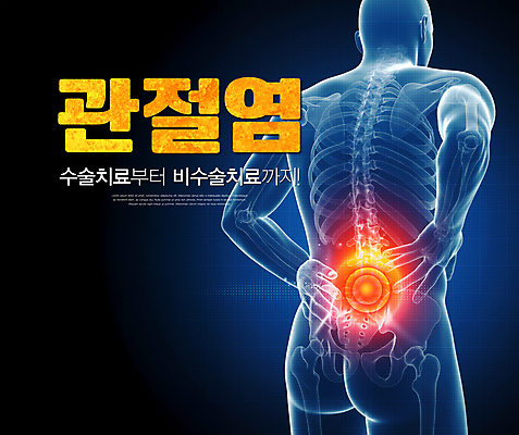 PSD 편집이미지 허리손 뼈 사람모양 엑스레이 치료 파란색 고통 수술 관절염 허리디스크 허리통증 이미지편집 모양 감정 컬러 포즈 의학 디스크_질병 질병 파일형식