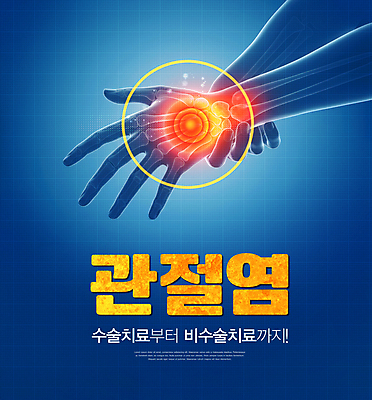 PSD 편집이미지 손 뼈 사람모양 엑스레이 치료 파란색 고통 잡기 수술 관절염 손목통증 이미지편집 모양 감정 컬러 의학 모션 신체부위 질병 파일형식