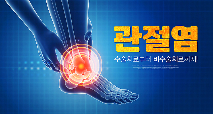 PSD 편집이미지 손 뼈 사람모양 엑스레이 치료 파란색 고통 잡기 수술 관절염 발목통증 이미지편집 모양 감정 컬러 의학 모션 신체부위 질병 파일형식