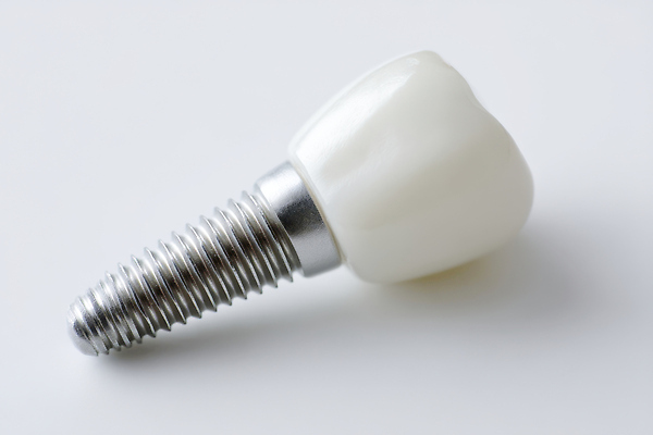 JPG 편집이미지 사람없음 수술 치아 임플란트 편집실사 편집3D AI컴퓨터그래픽 AI콘텐츠 의학 치과 치료 3D 소화기관 CG 파일형식