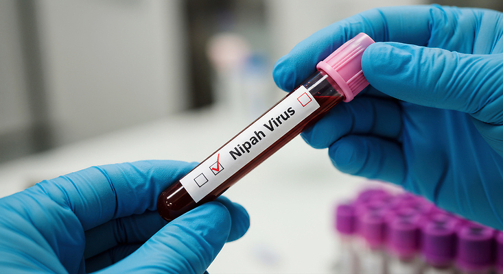 JPG 편집이미지 손 장갑 병원 들기 근접촬영 신체부위 유행 혈액 병 질병 체크표시 감염 방역 혈액검사 의료성형뷰티 검역 편집실사 니파바이러스 AI인물포토 AI콘텐츠 식기 잡화 뷰포인트 의학 모션 사람 바이러스 위생 CG 확인 검사_조사 파일형식 AI포토