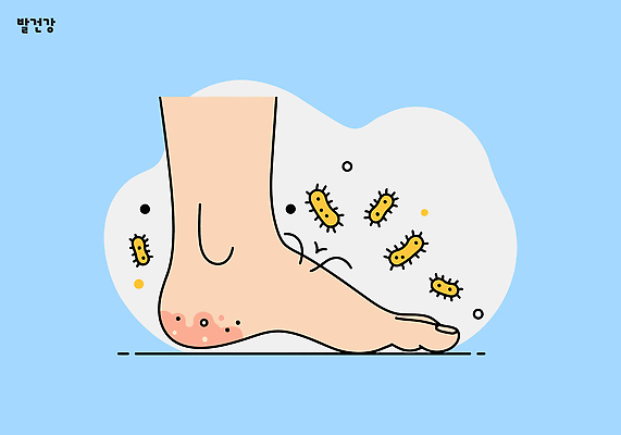 신발 일러스트 발 건강 관리 치료 청결 고통 습기 위생 피부 예방 감염 문제 발가락 탐색 박테리아 두드러기 발열 전염병 증상 국내일러스트 AI파일 감정 의학 신체부위 질병 알레르기 파일형식 벡터