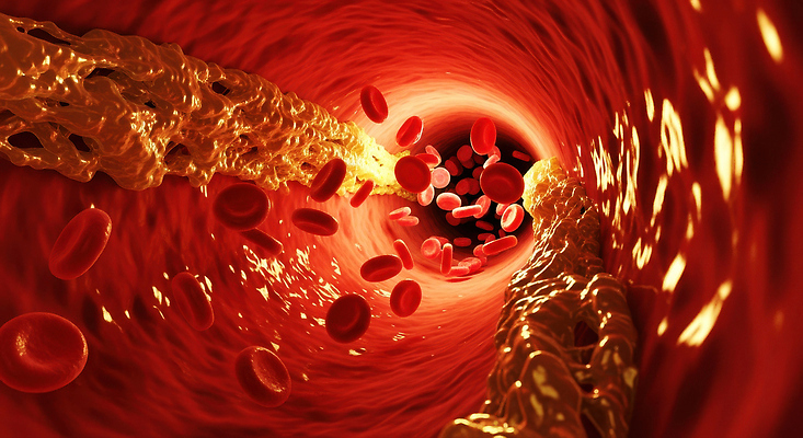 JPG 편집이미지 해부 건강 혈액 순환 혈관 적혈구 동맥 산소 영양소 콜레스테롤 편집실사 AI컴퓨터그래픽 AI콘텐츠 의학 모션 장기_의학 원소 CG 혈구 파일형식