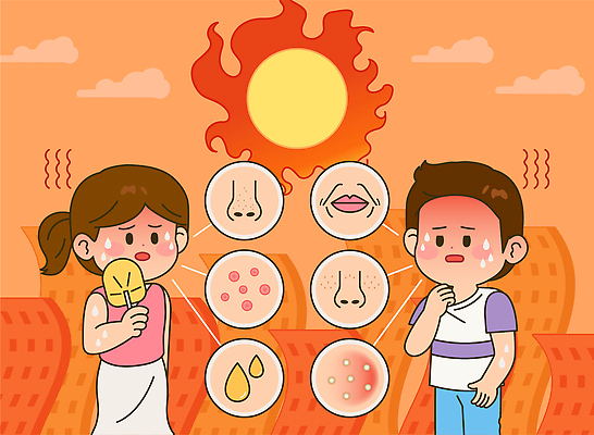채소 과일 일러스트 날씨 아이스크림 건강 소녀 소년 여름 햇빛 태양 고통 더위 수분 피부 기온 증상 피부트러블 국내일러스트 AI파일 자연요소 계절 여자 남자 감정 어린이 디저트 신체부위 피부질환 파일형식 벡터