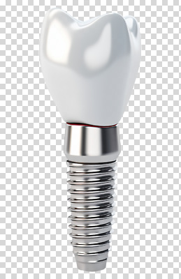 편집이미지 디자인 치과 치료 금속 환자 구출 치아 치과의사 PNG 임플란트 의학 재질 병원 의사 도움 소화기관 파일형식