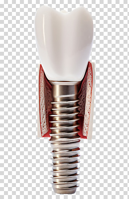 편집이미지 의학 치과 치료 고통 구출 치아 구강 PNG 기능 안정성 임플란트 감정 병원 도움 입 소화기관 파일형식