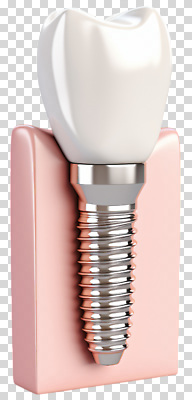 모델 편집이미지 디자인 의학 기술 건강 치과 치료 환자 수술 치아 구강 PNG 임플란트 잇몸 치아건강 신체 병원 입 소화기관 파일형식