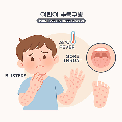 어린이 일러스트 의학 건강 치료 부모 진료 의사 정보 질병 피부 예방 발열 안내서 염증 증상 인후통 수족구병 불편함 국내일러스트 AI파일 가족 사람 신체부위 의료진 감각 파일형식 벡터