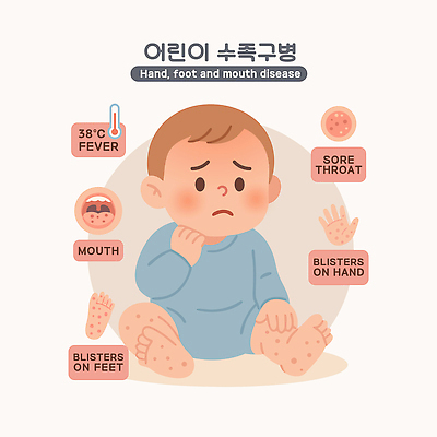 손 어린이 일러스트 가족 발 병원 종류 치료 간호사 의사 뜨거움 질병 예방 감염 증상 수족구병 국내일러스트 AI파일 의학 관계 사람 신체부위 의료진 파일형식 벡터