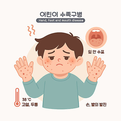 손 어린이 일러스트 발 건강 치료 부모 고통 뜨거움 질병 구강 불안 간호 예방 감염 두드러기 증상 수족구병 불편함 국내일러스트 AI파일 감정 의학 가족 사람 신체부위 입 감각 알레르기 파일형식 벡터