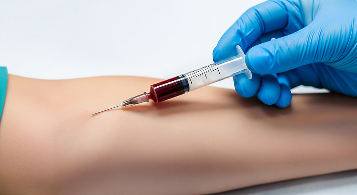 JPG 편집이미지 의학 건강 병원 주사기 치료 견본 환자 간호사 의료진 혈액 수집 팔 건강검진 순서 의료성형뷰티 편집실사 AI인물포토 AI콘텐츠 직업 의료기기 신체부위 CG 검사_조사 파일형식 AI포토