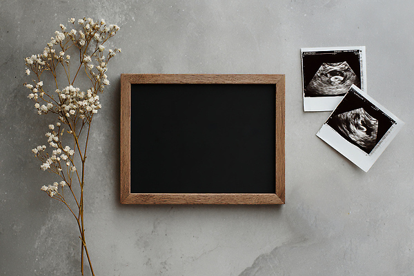 JPG 나무 편집이미지 꽃 액자 백그라운드 가족 탁자 건조 임신 회색 아기 장면 위 두장 초음파 초음파사진 편집실사 AI포토 AI콘텐츠 식물 컬러 가구 2 관계 사람 방향 CG 파일형식