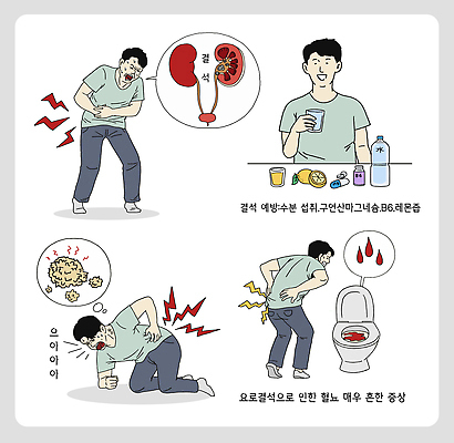 남자 음식 과일 일러스트 건강 병원 생활 치료 물 운동 고통 신장 질병관리 예방 증상 불편함 결석 요로결석 수분_꽃가루 국내일러스트 AI파일 자연요소 감정 의학 사람 감각 비뇨기관 질병 파일형식 벡터