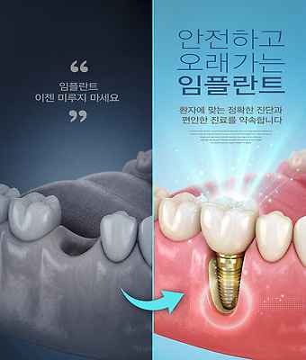PSD 편집이미지 건강 치과 관리 치료 진료 정보 치아 상담 예방 시술 임플란트 이미지편집 의학 병원 소화기관 파일형식 장기 신체