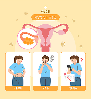 여자 일러스트 건강 관리 정보 몸무게 문제 여드름 난소 생리 여성질환 증상 불규칙 호르몬 증후군 국내일러스트 AI파일 컨셉 사람 질병 생리현상 파일형식 벡터 의학 현상