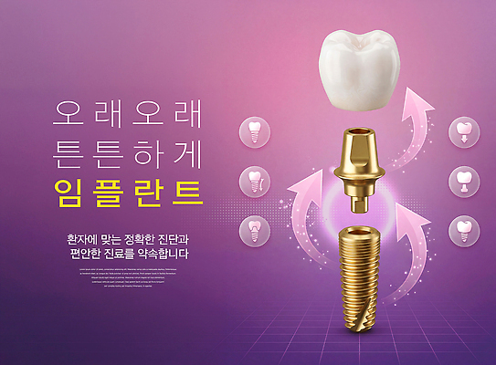 PSD 편집이미지 의학 건강 치과 치료 금속 진료 환자 수술 치아 순서 방법 임플란트 이미지편집 재질 병원 소화기관 파일형식 장기 신체