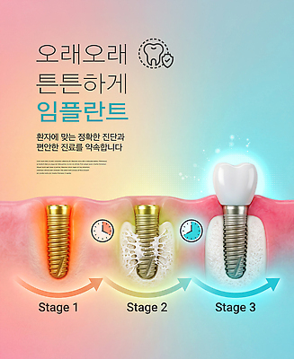 PSD 편집이미지 기술 건강 치과 치료 진료 환자 수술 치아 과정 단계 임플란트 이미지편집 컨셉 의학 병원 소화기관 파일형식 장기 신체