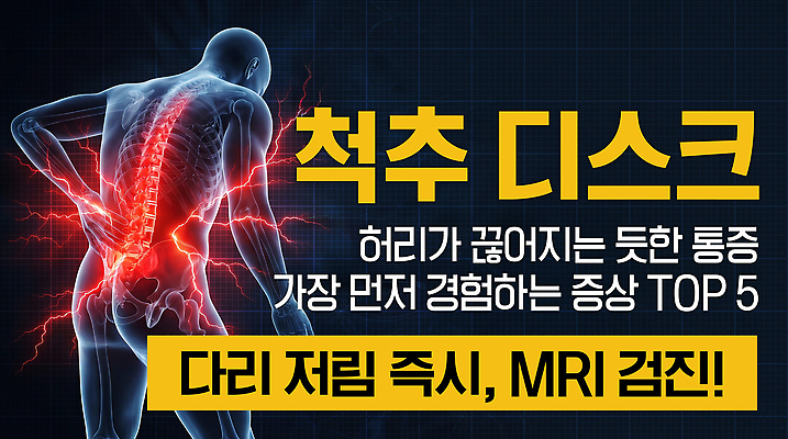 PSD 편집이미지 엑스레이 건강 진료 고통 디스크 허리 척추 문제 MRI 요통 증상 이미지편집 감정 의학 의료기기 뼈 신체부위 질병 허리통증 파일형식 사람