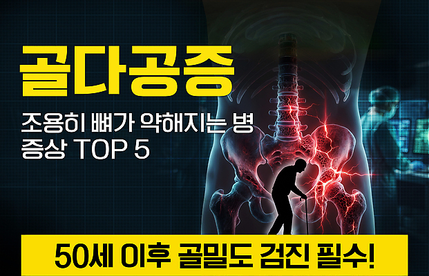 PSD 편집이미지 의학 뼈 엑스레이 건강 건강관리 정보 예방 골다공증 증상 이미지편집 관리 질병 파일형식