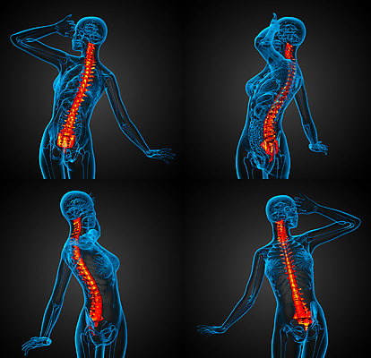 포토 JPG 해외이미지 해부 뼈 골격 사람없음 3D 척추 생물학 요통 해외202004 해외포토 교육 의학 디지털합성 허리통증 파일형식