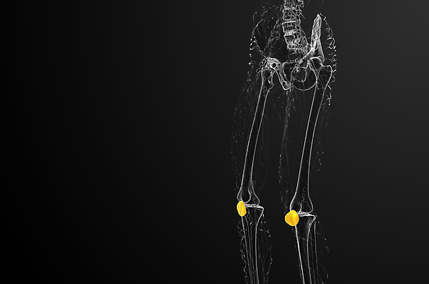 포토 JPG 해외이미지 해부 뼈 사람없음 고통 무릎 외과 양발 연골 증상 해외202004 해외포토 감정 의학 병원 신체부위 파일형식