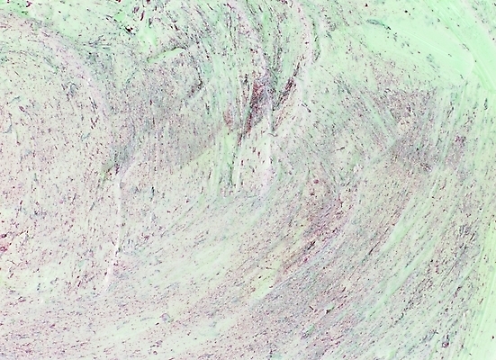 포토 컬러 백그라운드 무늬 패턴 붓터치 회화 미술 근접촬영 사람없음 연두색 페인트 색칠 페인트칠 그림 질감 덧칠 유화 유화물감 국내포토 뷰포인트 페인팅 문화예술 말하기 초록색 물감 파일형식