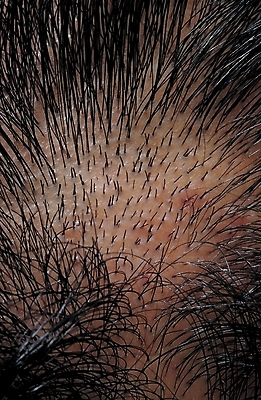 포토 JPG 신체 사람 근접촬영 신체부위 머리카락 머리 두피 국내포토 뷰포인트 파일형식