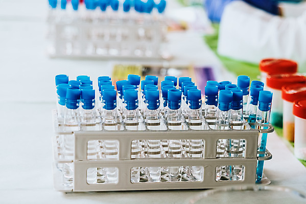 포토 JPG 해외이미지 교육 산업 과학 백그라운드 유리 건강 병원 실험 사람없음 파란색 스터디 약 장비 흰색 기구 공구 투명 액체 혈액 실험실 생명공학 컨테이너 플라스틱 약국 과학자 플라스크 분석 시험관 생물학 미생물 유리그릇 튜브 발견 조제 개발 신발장 피펫 화학물질 화학자 해외202004 해외포토 직업 그릇 컬러 컨셉 의학 재질 생물 실험기구 학습 도구 화학 만들기 학자 파일형식