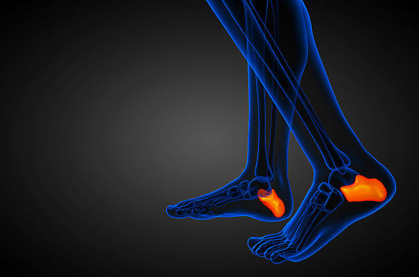 포토 JPG 해외이미지 뼈 골격 건강 사람 사람없음 고통 환자 발목 양발 정형외과 해외202004 해외포토 감정 의학 발 병원 파일형식