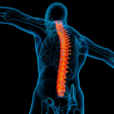 포토 JPG 해외이미지 백그라운드 신체 일러스트 뼈 골격 엑스레이 사람없음 빨간색 파란색 3D 검은색 고통 투명 척추 관절염 몸통 염증 요통 해외202004 해외포토 감정 컬러 의학 신체부위 질병 디지털합성 허리통증 파일형식