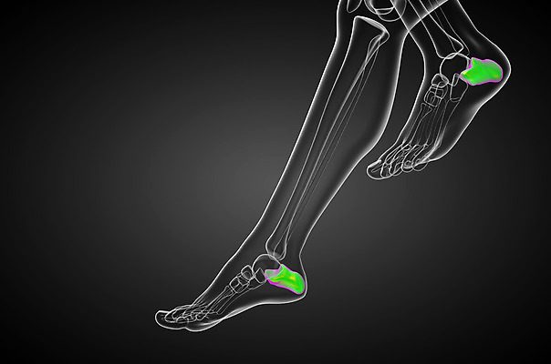 포토 JPG 해외이미지 뼈 골격 건강 사람 사람없음 고통 환자 발목 양발 정형외과 해외202004 해외포토 감정 의학 발 병원 파일형식