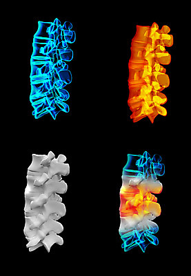 포토 JPG 해외이미지 백그라운드 신체 일러스트 뼈 골격 엑스레이 사람없음 파란색 3D 검은색 고통 투명 척추 몸통 염증 요통 해외202004 해외포토 감정 컬러 의학 신체부위 질병 디지털합성 허리통증 파일형식