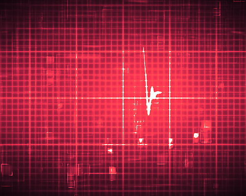 포토 JPG 해외이미지 선 분홍색 백그라운드 근육 추상 병원 사람없음 약 사각형 모니터 기계 고통 하트 심장 맥박 속도 애니메이션 심장병 심전도 해외202004 약함 해외포토 모양 도형 감정 컬러 컨셉 무늬 의학 컴퓨터 장기_의학 질병 파일형식