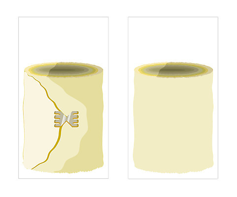 템플릿 배너템플릿 명함 명함템플릿 미니배너 치료 약 의료용품 붕대 이미지템플릿 배너 의학 의료기기 미니