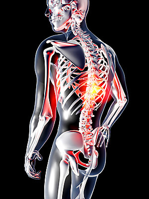 포토 JPG 해외이미지 교육 과학 포즈 신체 일러스트 해부 뼈 골격 엑스레이 건강 사람 성인 사람없음 스터디 약 3D 검은색 고통 광선 마사지 투명 질병 상처 지압 척추 관절염 생물학 골다공증 목 몸통 외과 방사선 염증 요통 해외202004 해외포토 감정 컬러 의학 병원 신체부위 학습 디지털합성 허리통증 파일형식