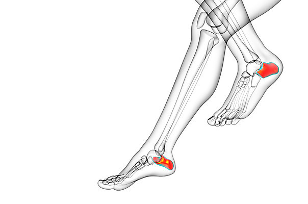 포토 JPG 해외이미지 뼈 골격 건강 사람 사람없음 고통 환자 발목 양발 정형외과 해외202004 해외포토 감정 의학 발 병원 파일형식