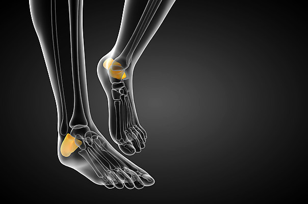 포토 JPG 해외이미지 뼈 골격 건강 사람 사람없음 고통 환자 발목 양발 정형외과 해외202004 해외포토 감정 의학 발 병원 파일형식