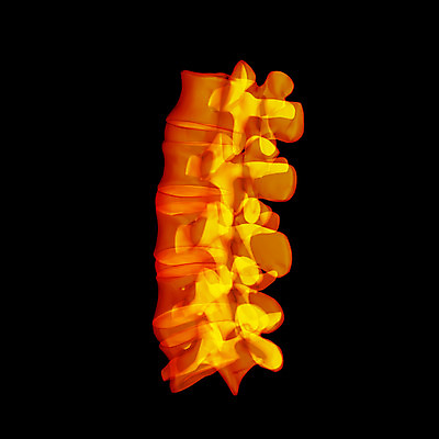 포토 JPG 해외이미지 백그라운드 신체 일러스트 뼈 골격 엑스레이 사람없음 파란색 3D 검은색 고통 투명 척추 관절염 몸통 염증 요통 해외202004 해외포토 감정 컬러 의학 신체부위 질병 디지털합성 허리통증 파일형식