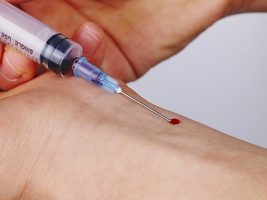 포토 JPG 손 의학 의료기기 주사기 신체부위 치료 약 의료용품 검사_조사 팔 채혈 국내포토 사람 파일형식