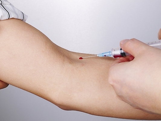 포토 JPG 손 의학 의료기기 주사기 신체부위 치료 약 의료용품 검사_조사 팔 채혈 국내포토 사람 파일형식